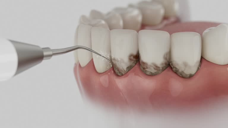 Reliable Dental Implants contractor in Elgin, SC by Smile Center Dentistry